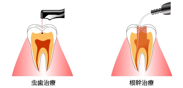 過敏 治療 知覚