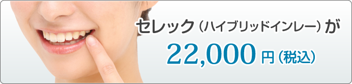 短時間でつめ物を作成　セレック（ハイブリッドインレー）が21,600円（税込）