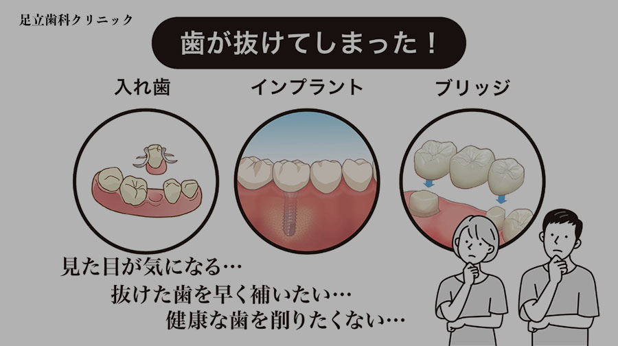 コンティース（部分入れ歯）｜大阪市阿倍野区の歯科・歯医者｜足立歯科