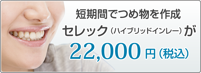 短期間でつめ物を作成！セレック（ハイブリッドインレー）が22,000円（税込）