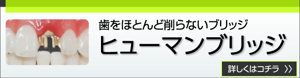 ヒューマンブリッジ