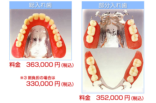 純チタン・チタン合金での総入れ歯・部分入れ歯