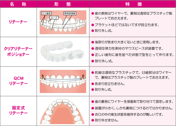 固定式リテーナー