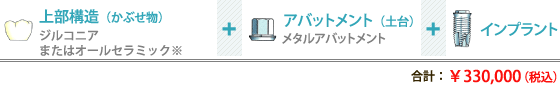 上部機構（かぶせ物）+アバットメント（土台）+インプラント 合計：253,000円（税込）～308,000円（税込）