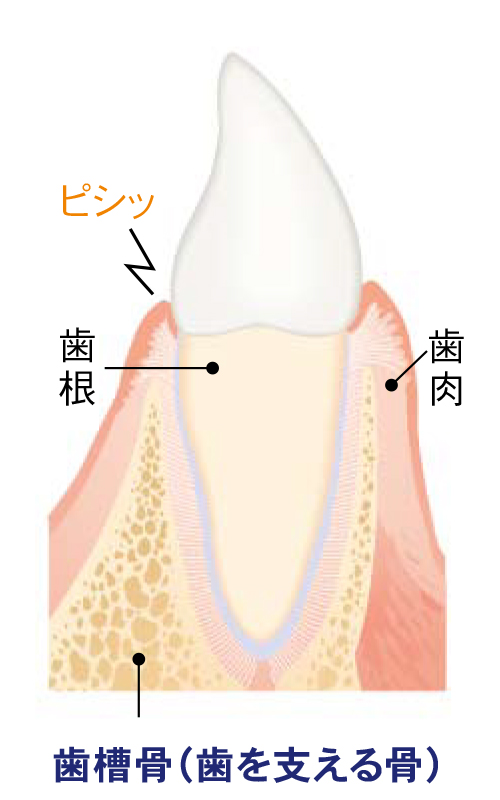 初期