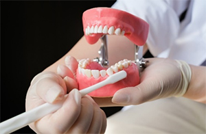 歯石を取り除きブラッシング指導